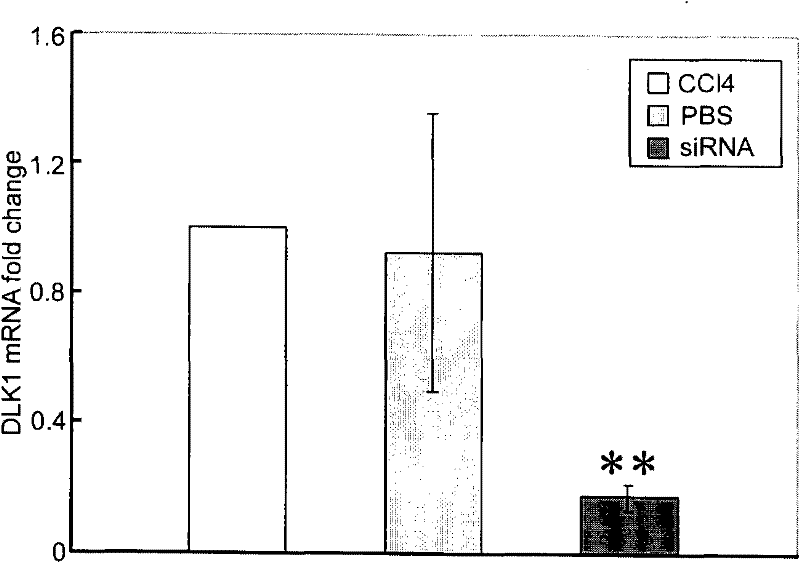 Applications of DLK1 gene, siRNA (small interference Ribonucleic Acid), BM-MSCs (Bone Marrow Mesenchymal Stem Cells) and FGF2 (Fibroblast Growth Factor2)