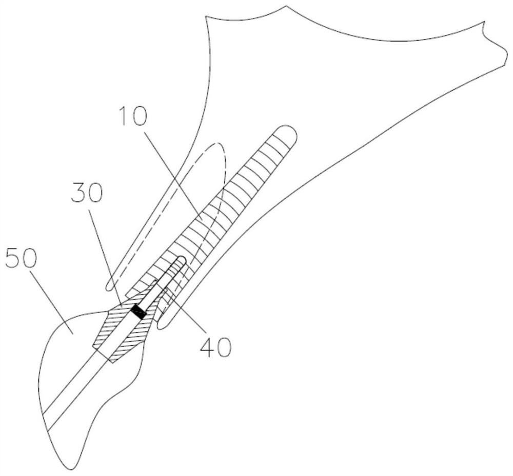 Double-shaft instant implanting oral implant structure