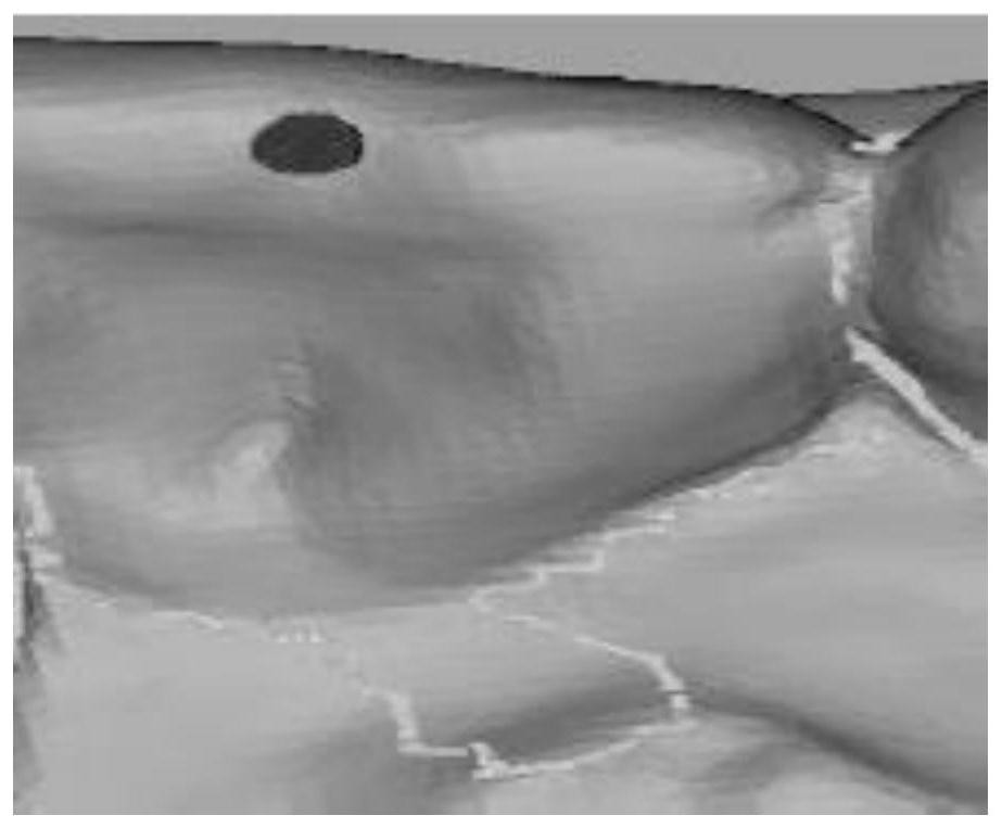 A 3D Dental Model Segmentation Method for Computer-Aided Invisible Orthodontics