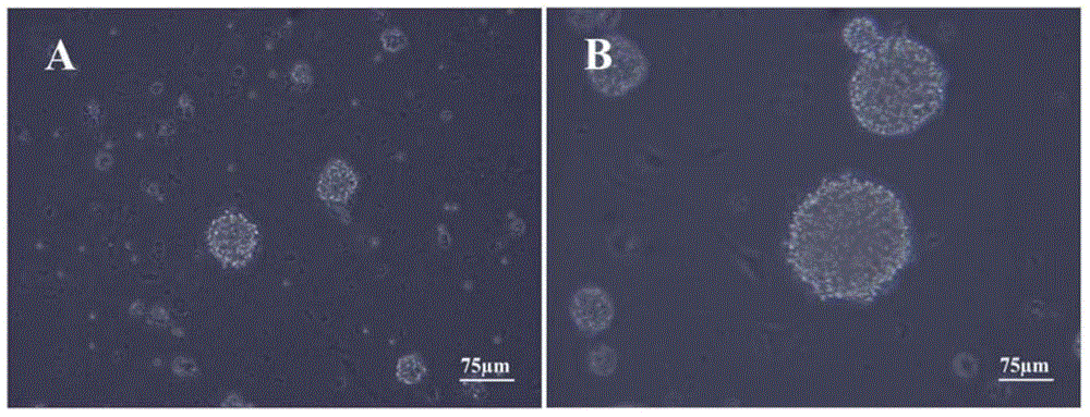 Culture medium for promoting differentiation of rat neural stem cells and use method of culture medium