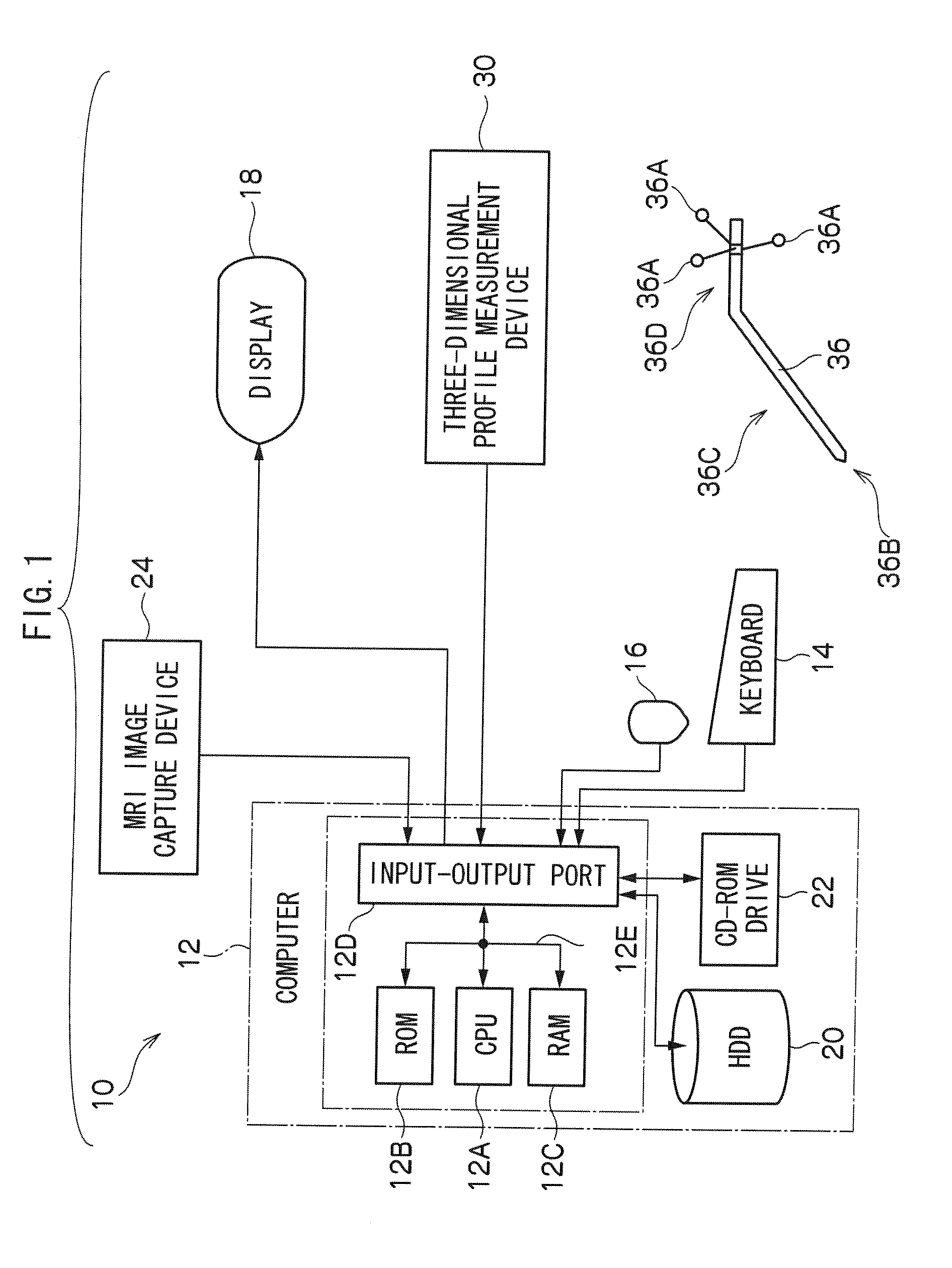 Surgery support device, surgery support method, and computer readable recording medium storing surgery support program