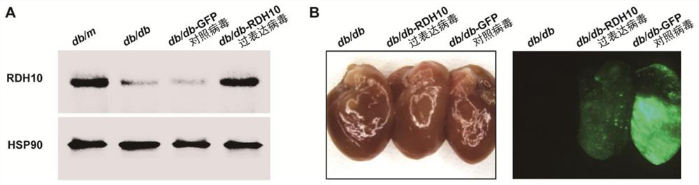 Application of RDH10 and/or prodrug thereof in preparation of medicine for treating and/or preventing diabetic myocardial injury