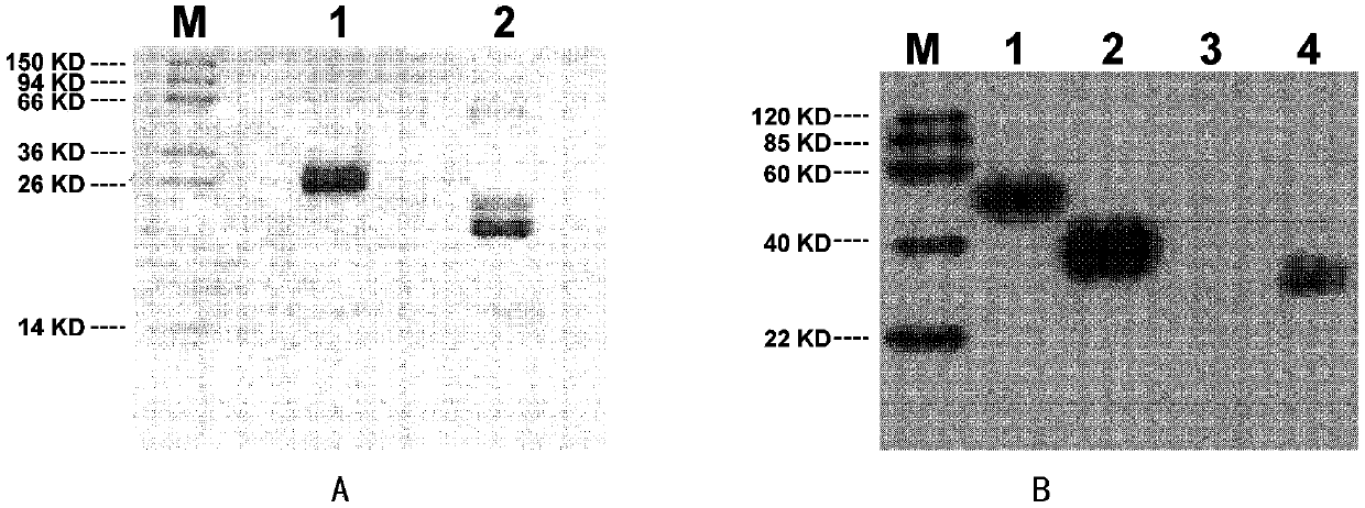 Insulin-like growth factor binding protein 4 mutant and pharmaceutical application thereof