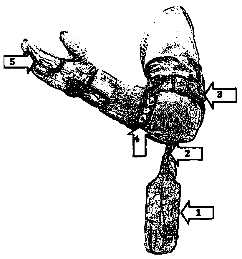 Wearable intelligent human knuckle assistance and recovery device