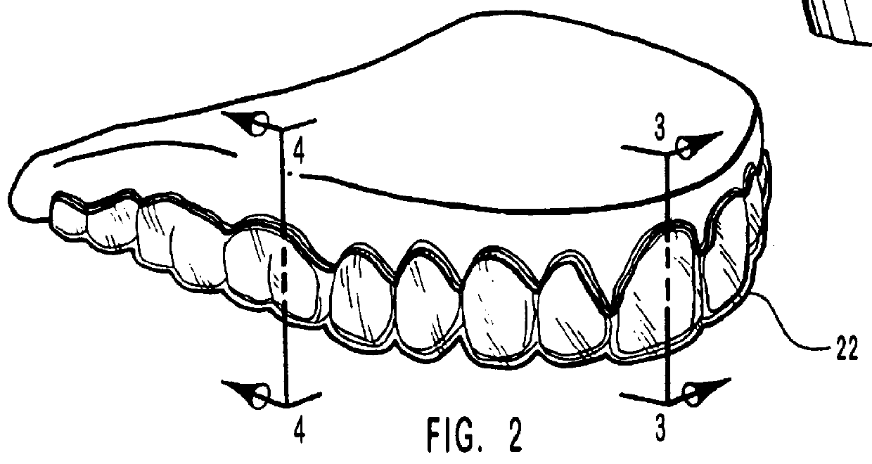 Methods for making scalloped dental trays for use in treating teeth with sticky dental compositions