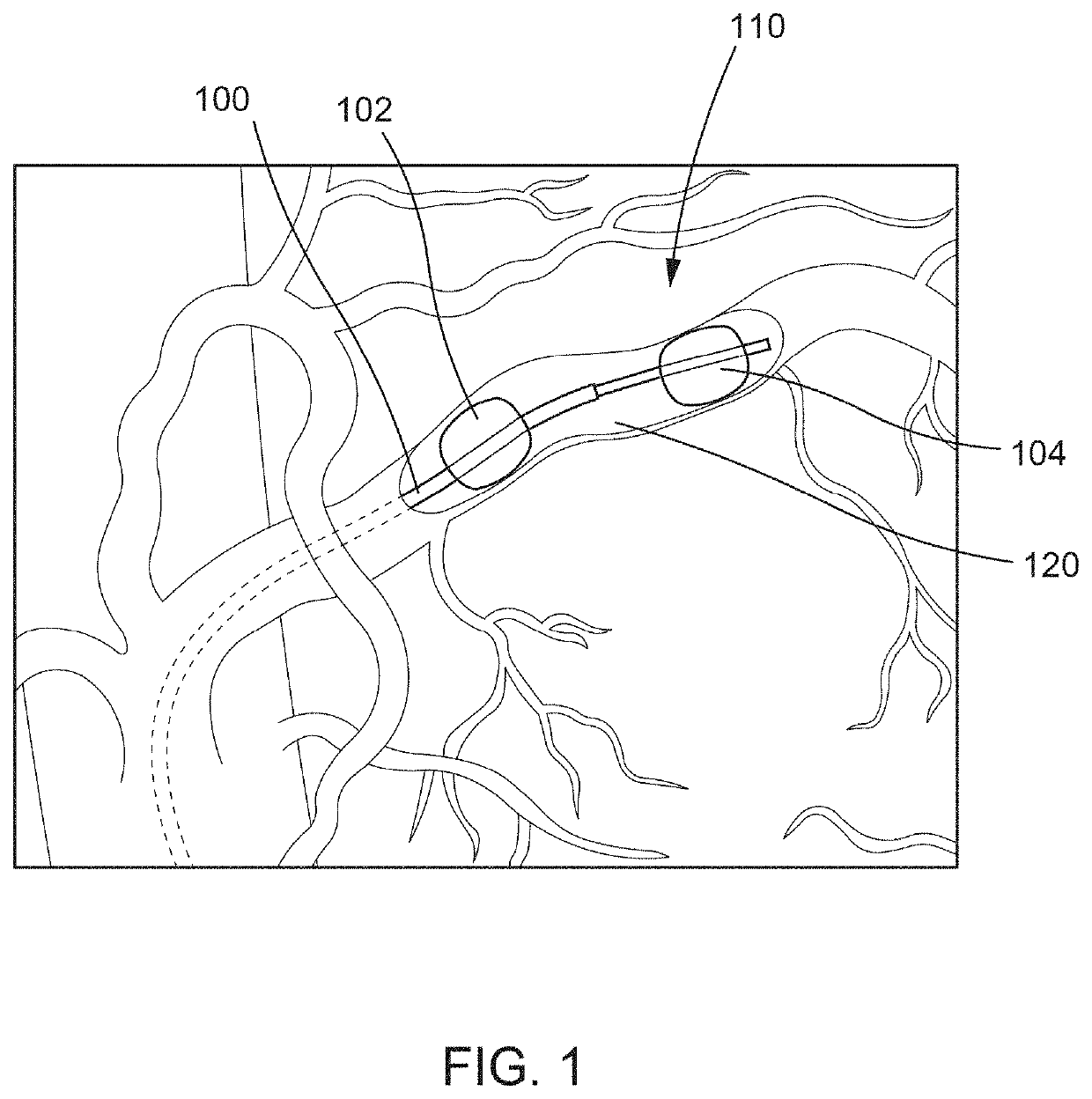 Methods for treating cancerous tumors