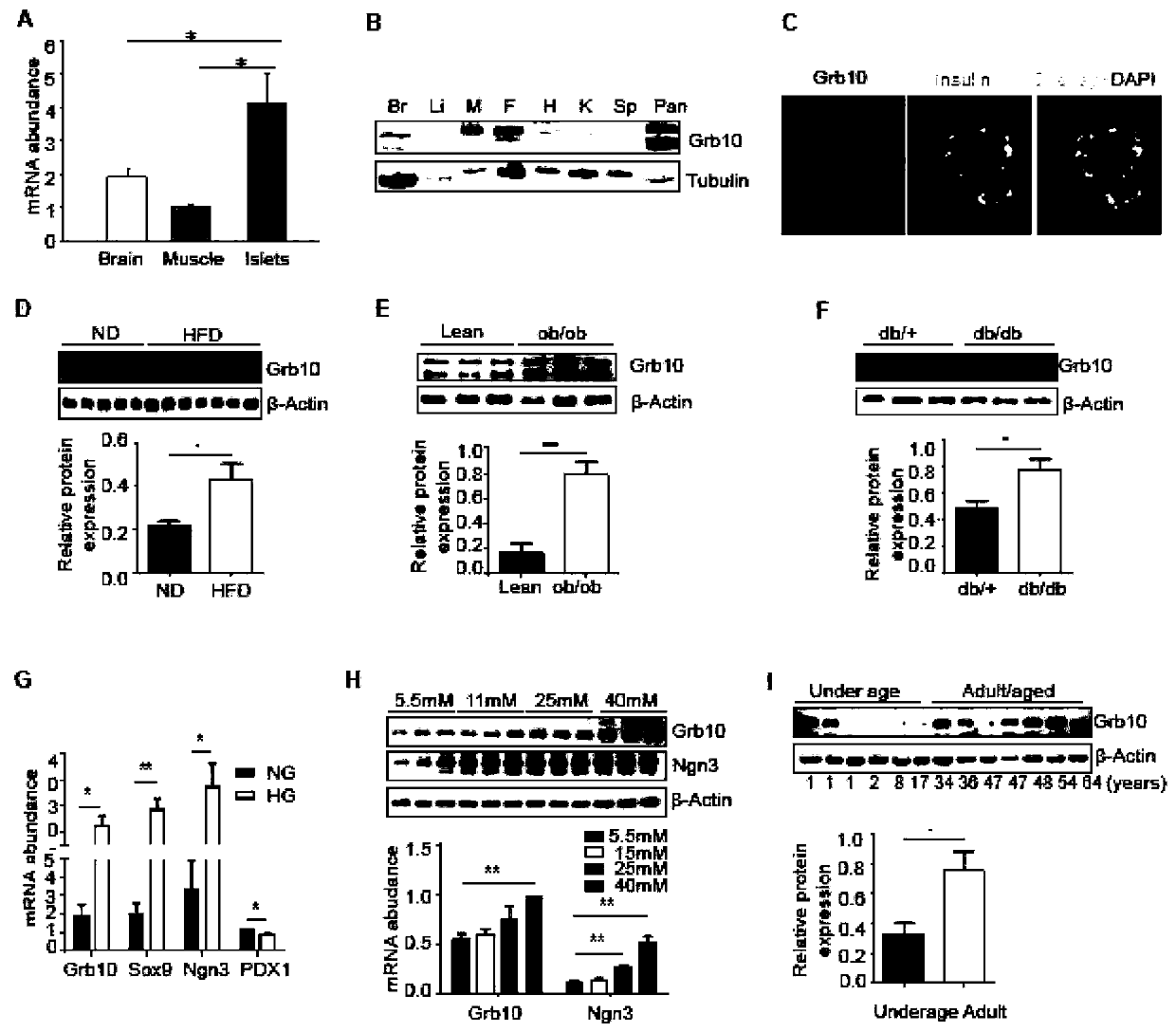 Application of Grb10 as key negative regulation factor of beta cell dysfunction
