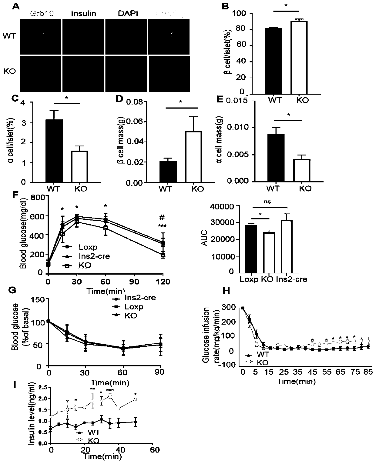 Application of Grb10 as key negative regulation factor of beta cell dysfunction