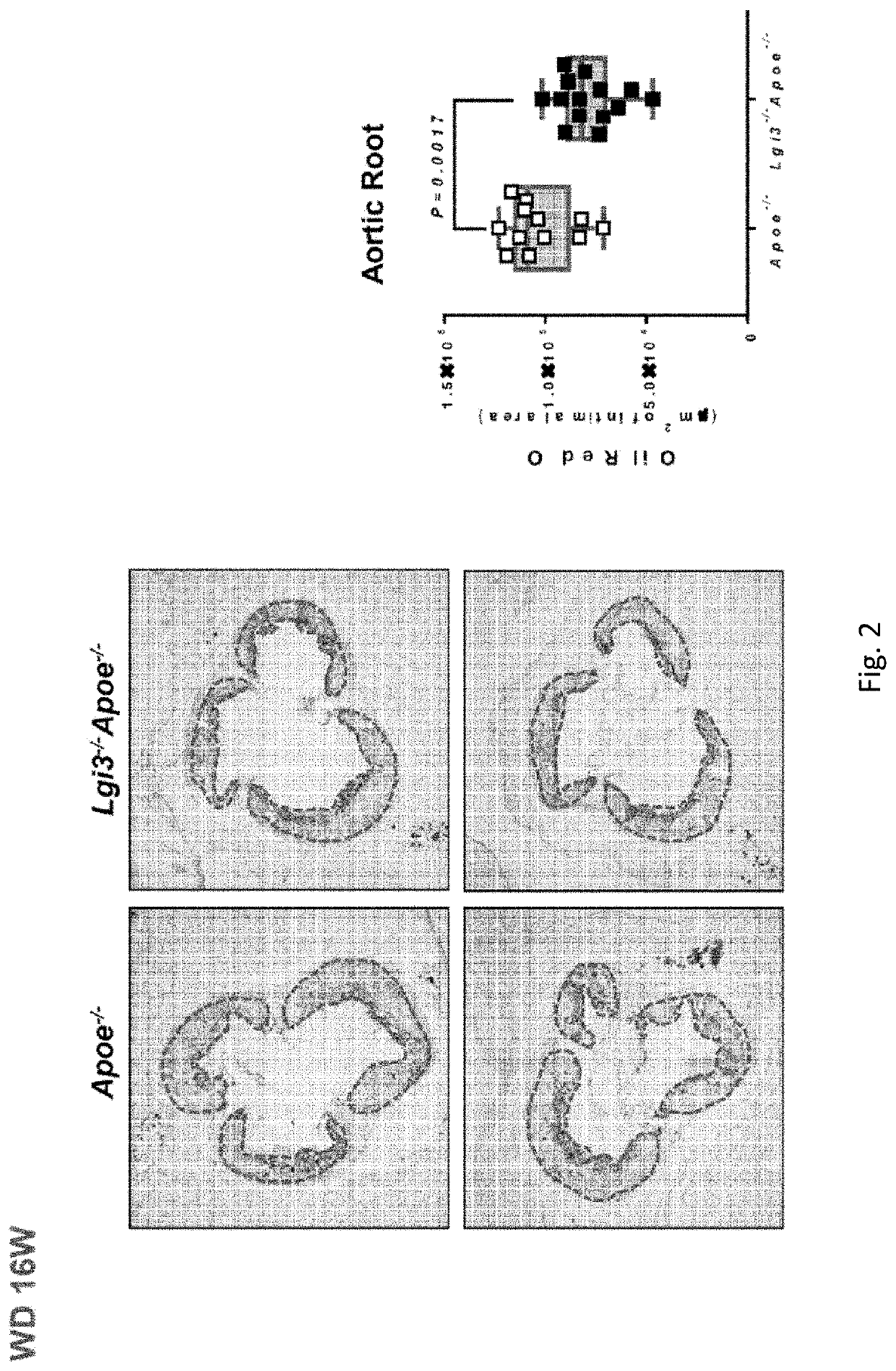 Marker for diagnosing atherosclerosis severity, and diagnostic method using same