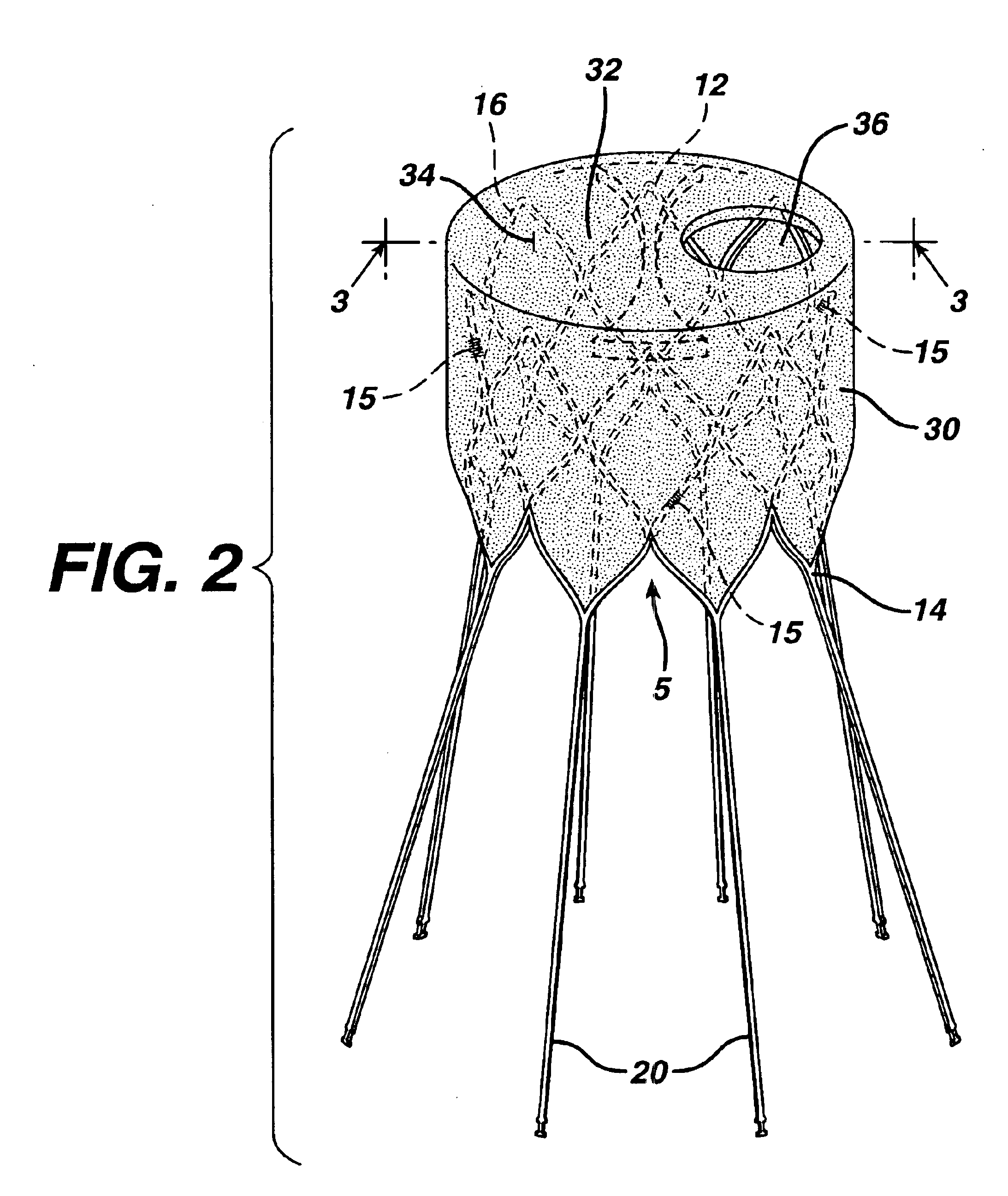 Delivery apparatus for a self expanding retractable stent