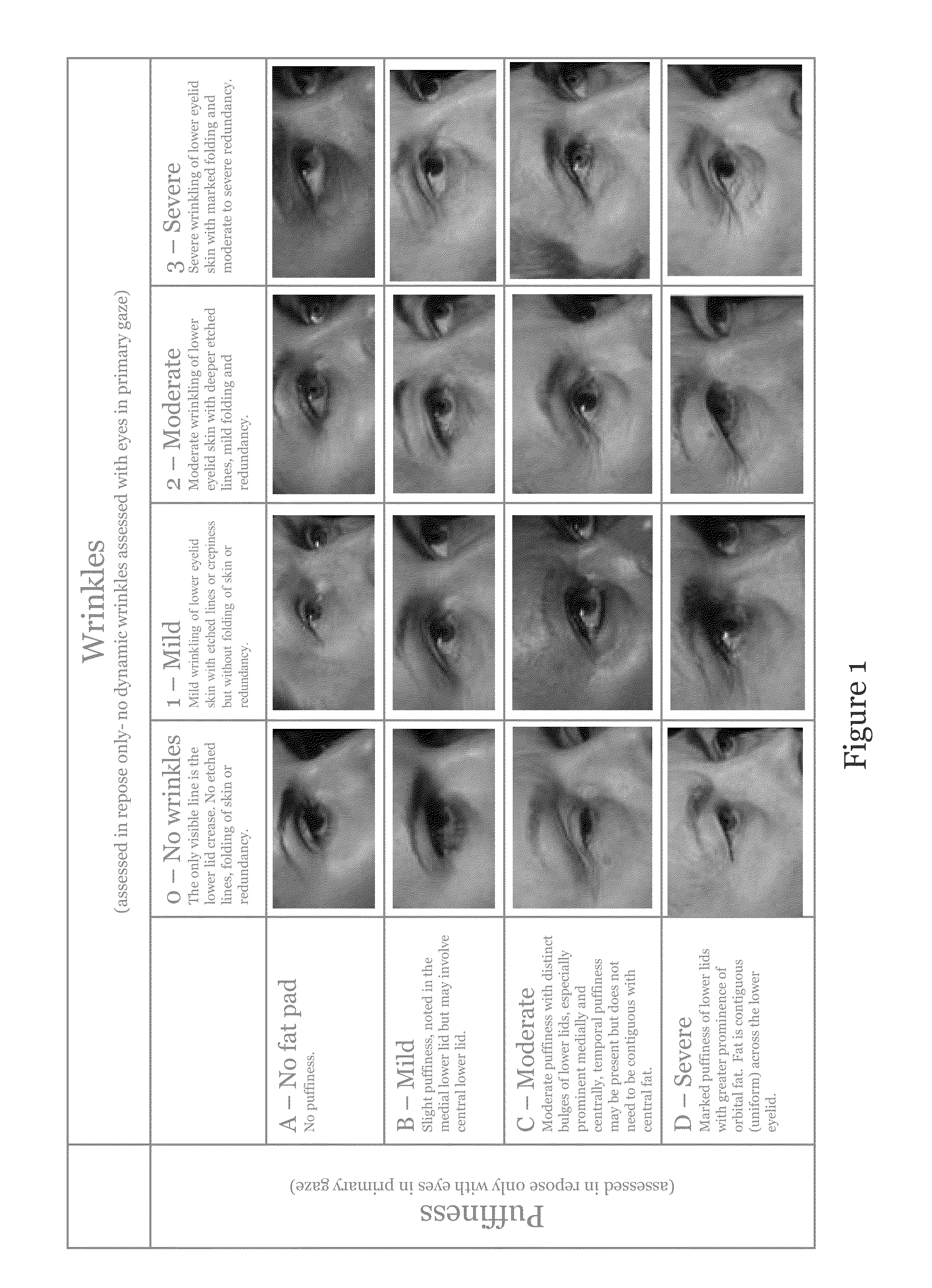 Scale and associated metric for treatment of facial wrinkles and related conditions