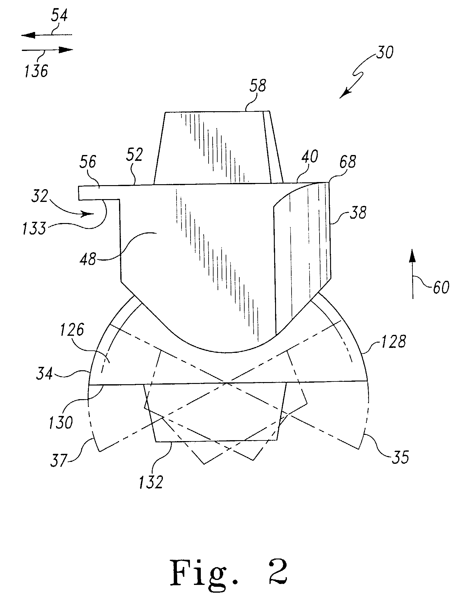 Ankle prosthesis with a front loading bearing and associated method