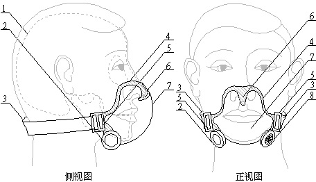 Separating type intelligent heat-removing social contact mask capable of realizing nose tip fixing