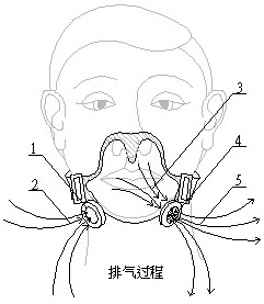 Separating type intelligent heat-removing social contact mask capable of realizing nose tip fixing