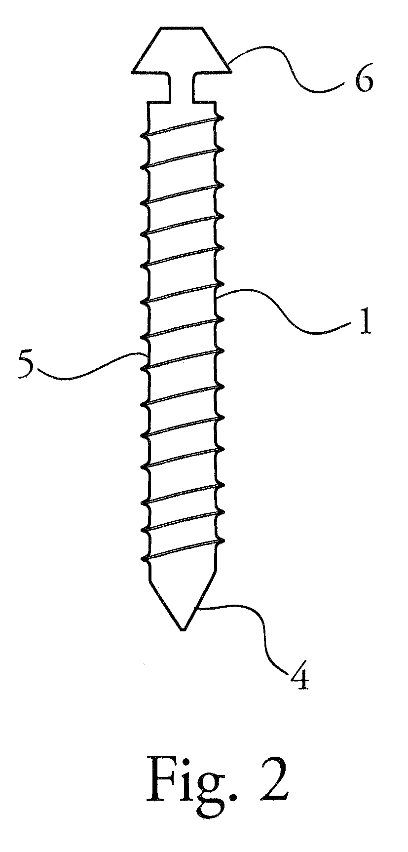 Device and method for implantation that restores physiologic range of motion by establishing an adjustable constrained motion of the spine without intrusion of associated facet joints