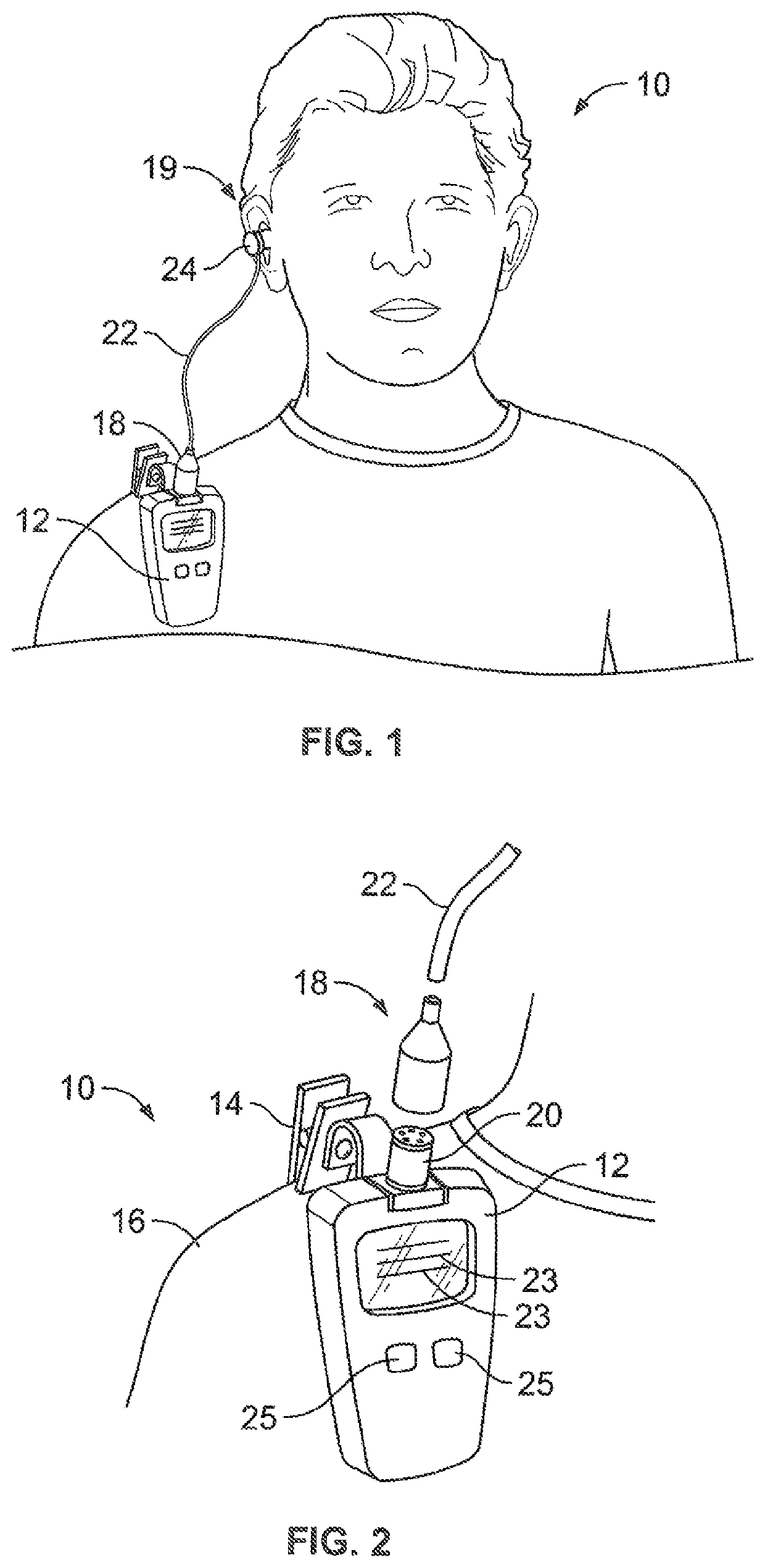 In-ear noise dosimeter