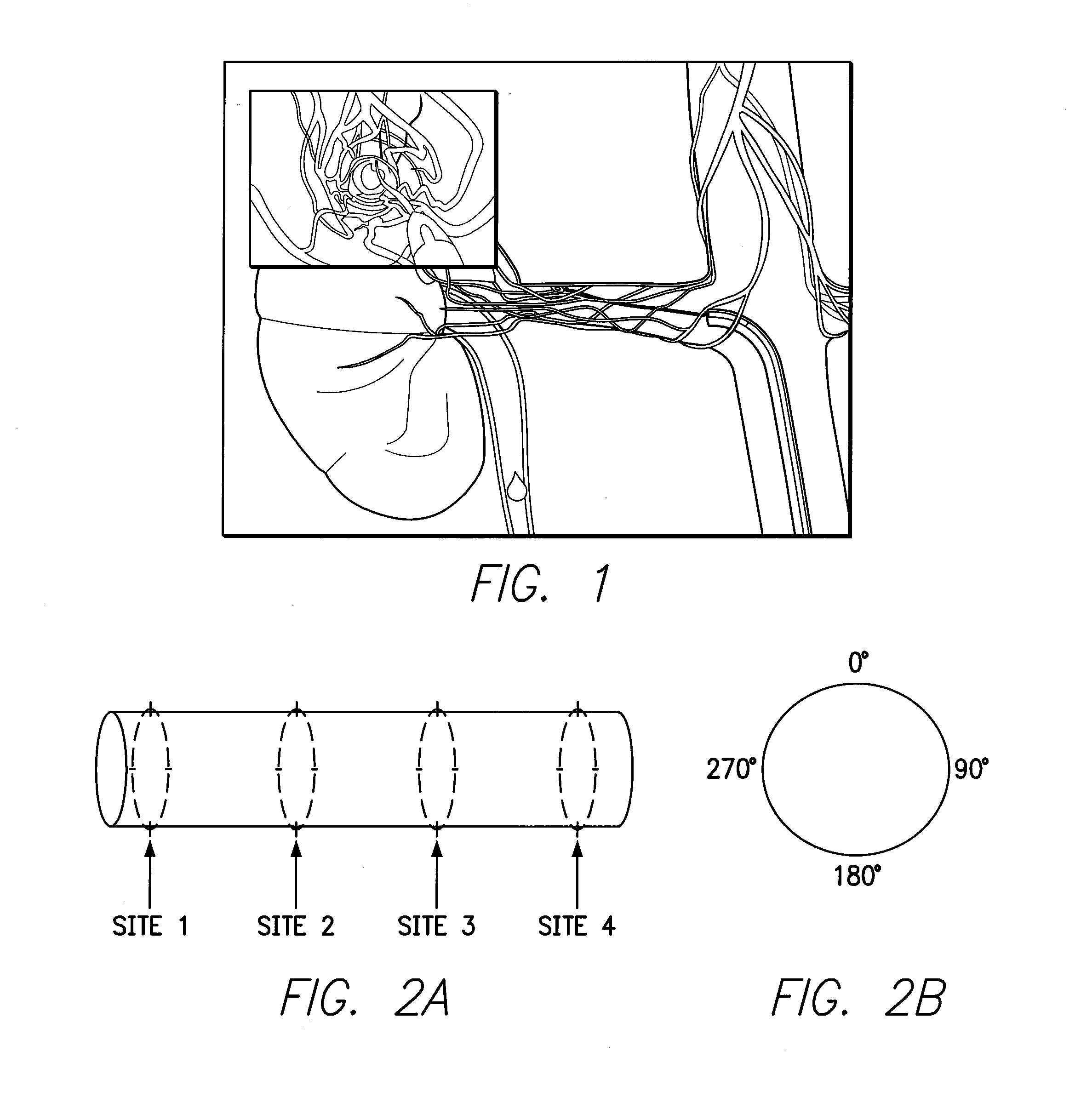 System and method for assessing renal artery nerve density