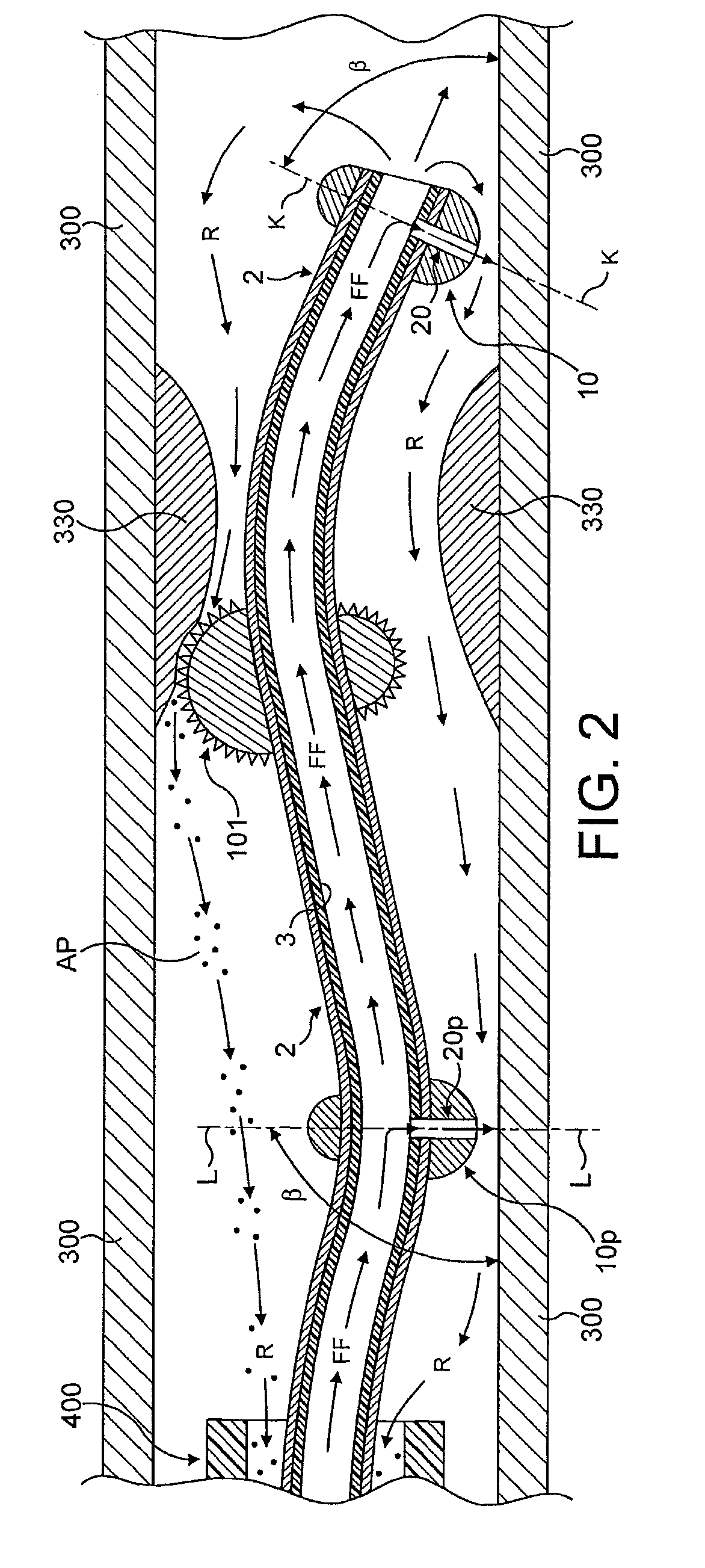 Atherectomy device supported by fluid bearings