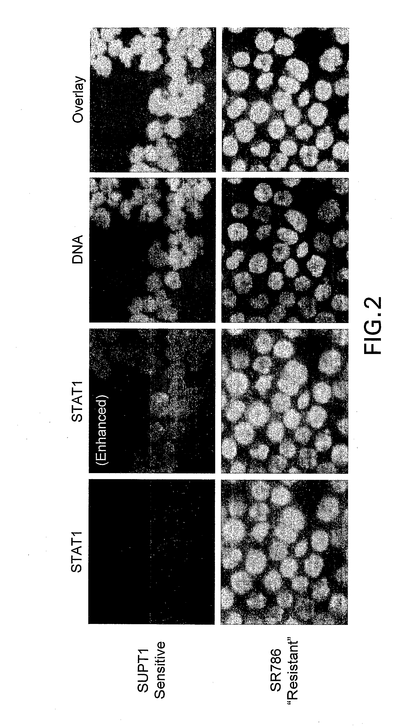 Methods for Predicting Treatment Response Based On the Expression Profiles of Protein and Transcription Biomarkers