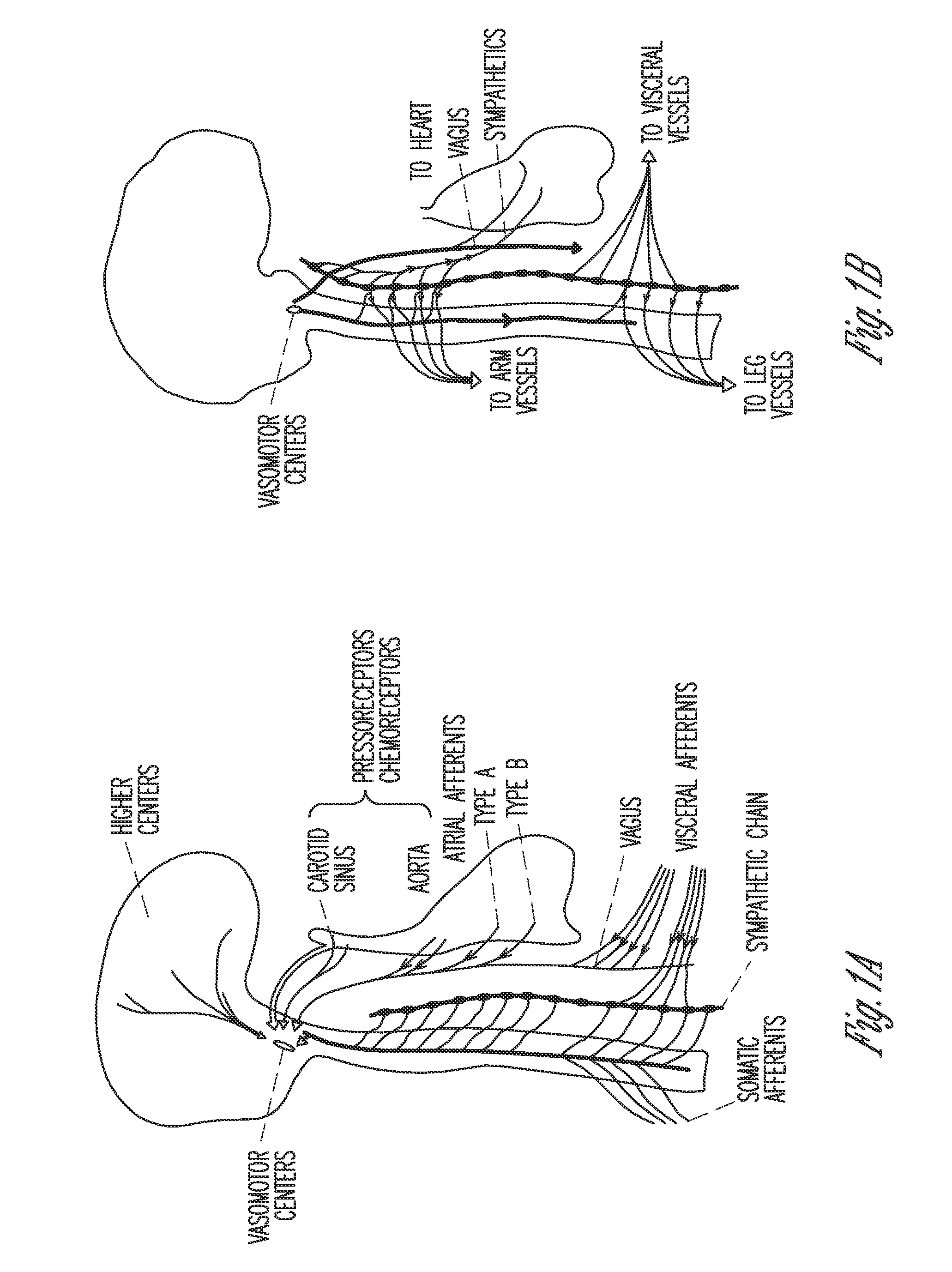 System and method for sustained baroreflex stimulation