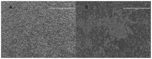 Zika virus vaccine and preparation method thereof