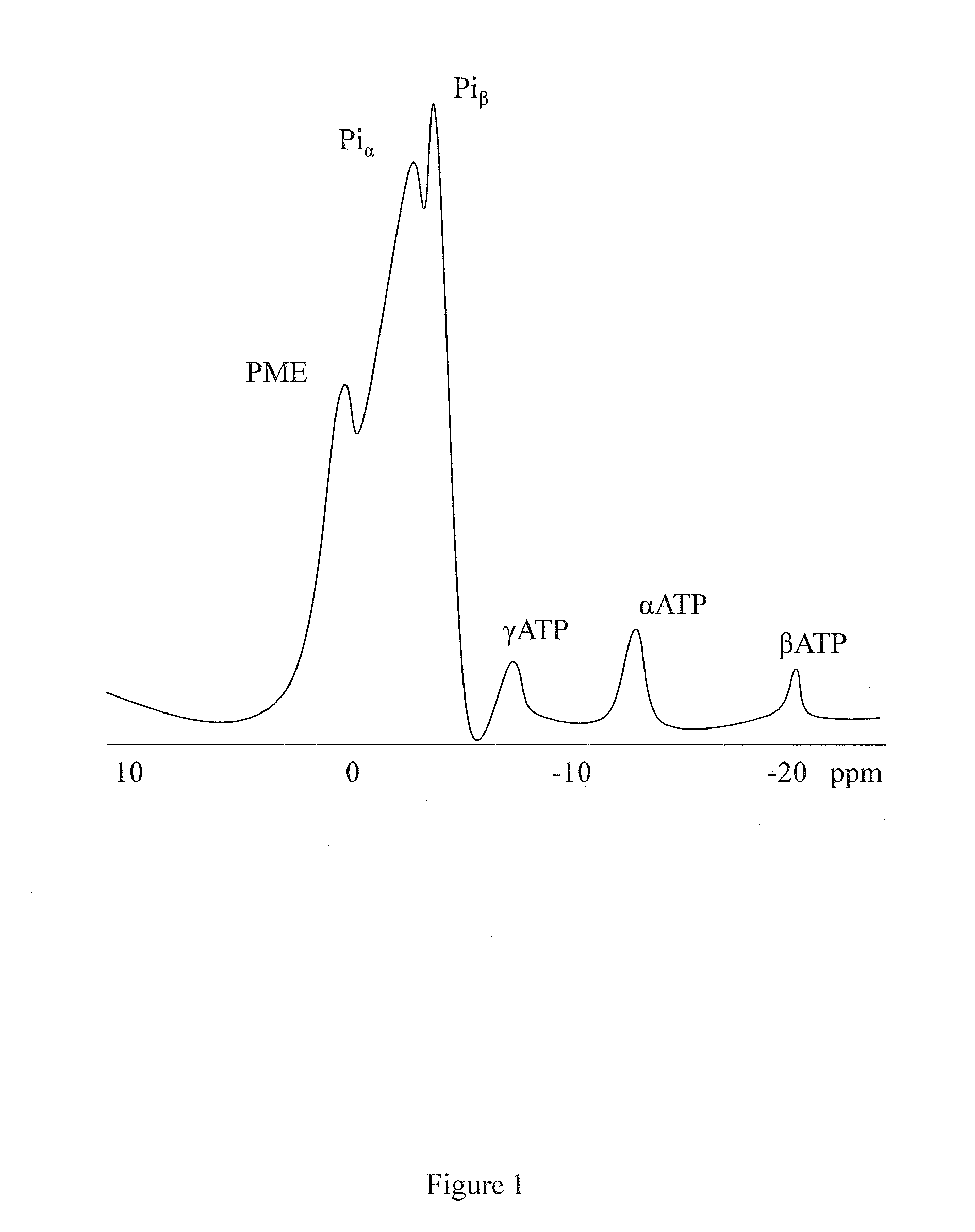 Organ viability