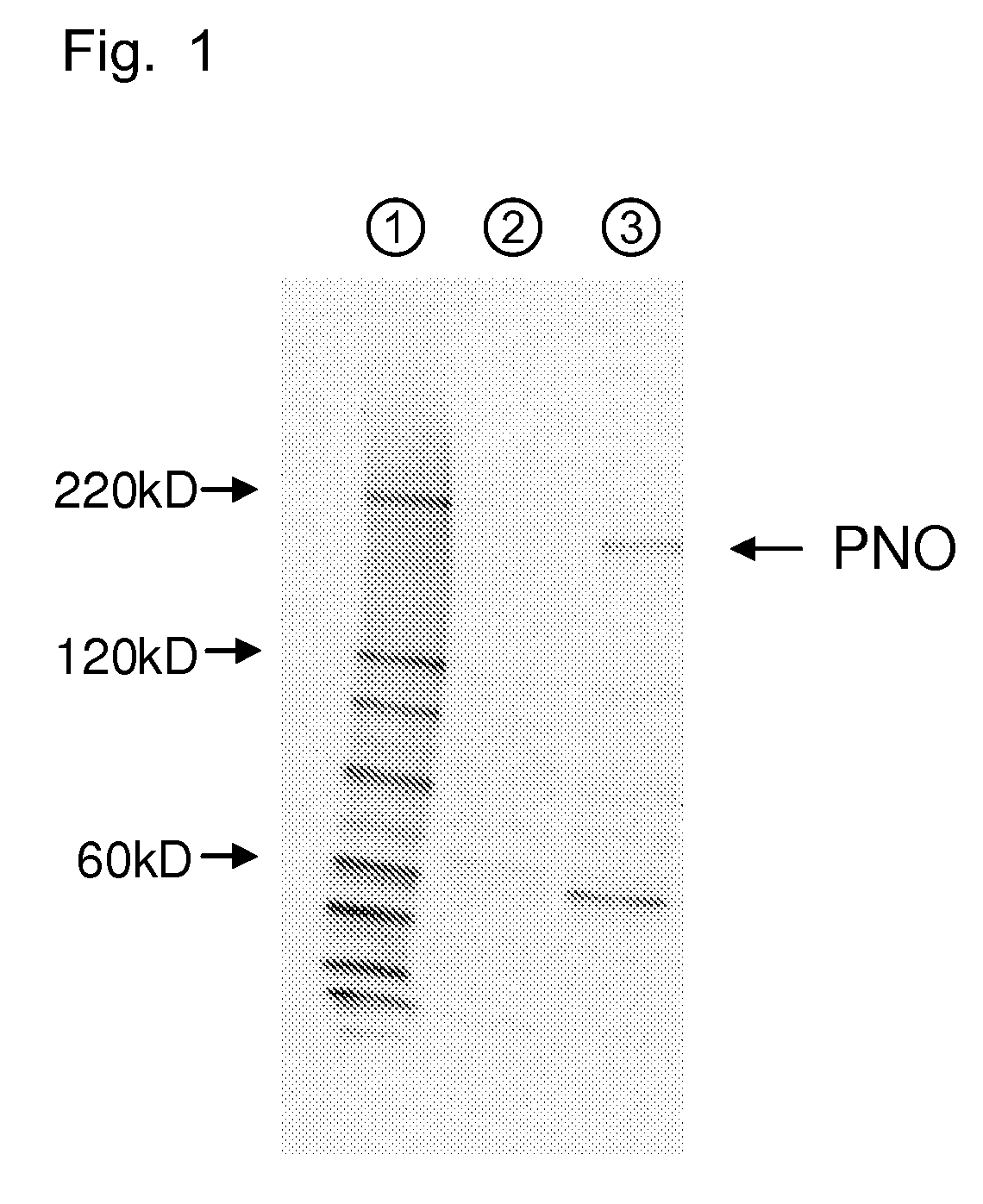 Amino acid producing microorganism and a method for producing an amino acid