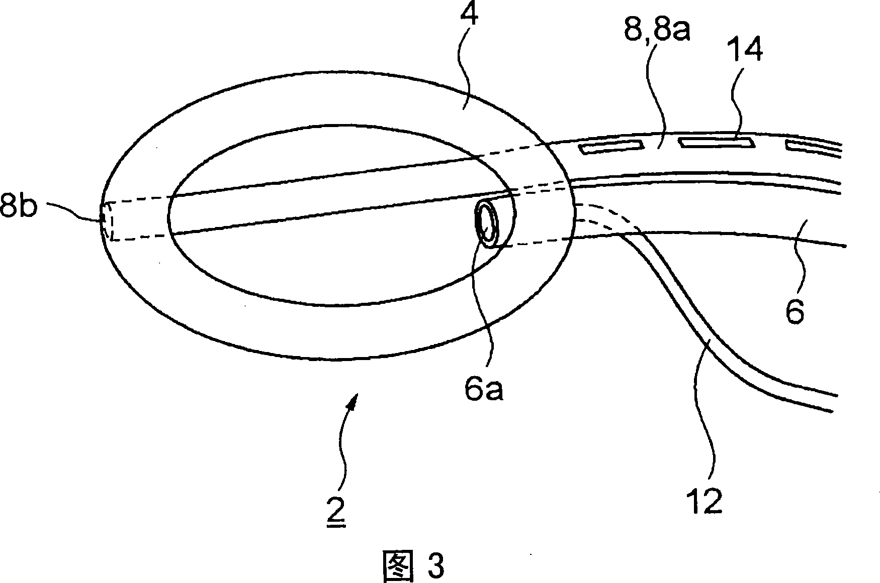 Laryngeal mask with guiding tube used for inserting stomach tube