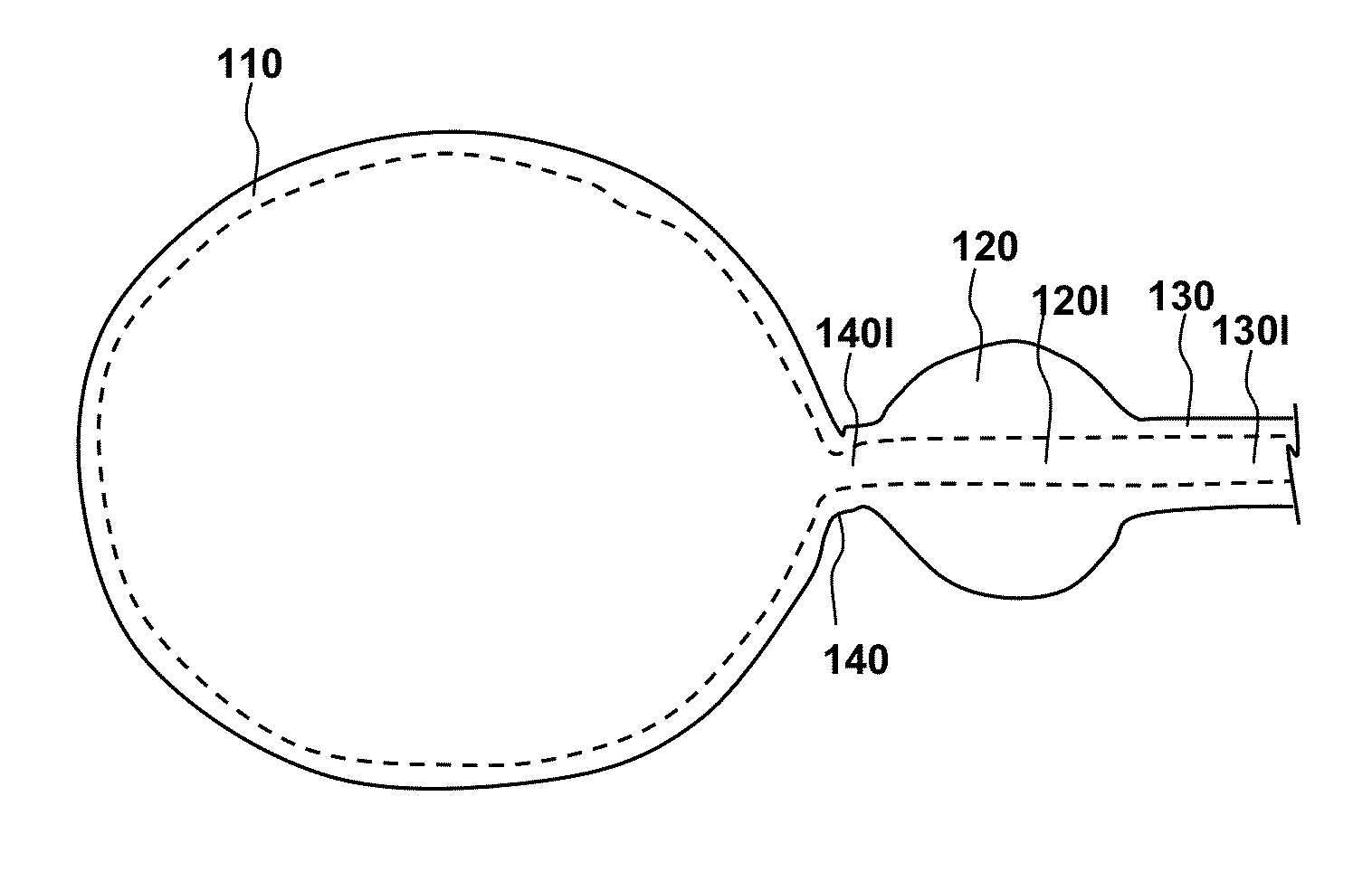 Methods, compositions and kits for performing anastomosis procedures in conjunction with a radical prostatectomy procedure