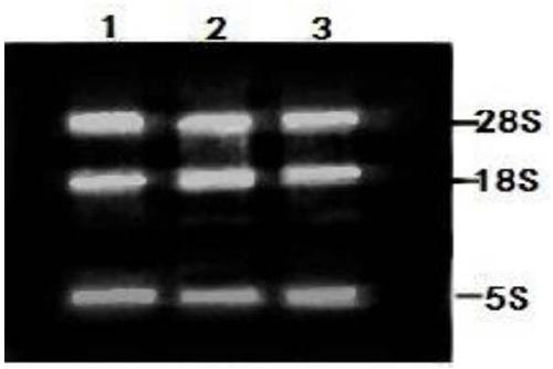 Lin28 B gene of duolang sheep and application of Lin28 B gene