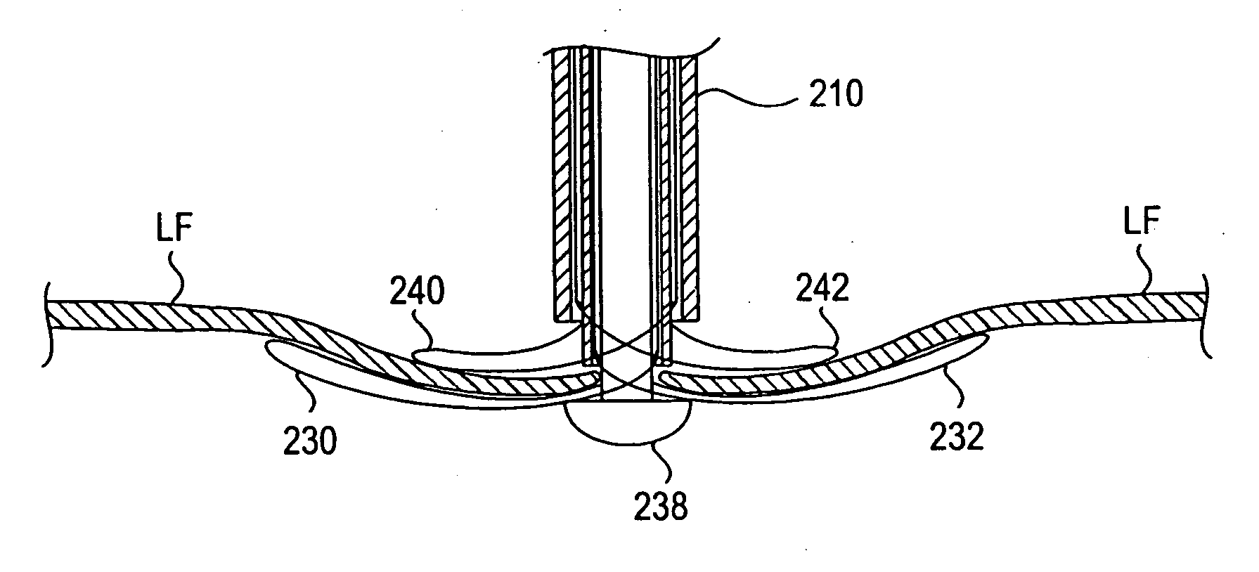Methods and devices for capturing and fixing leaflets in valve repair