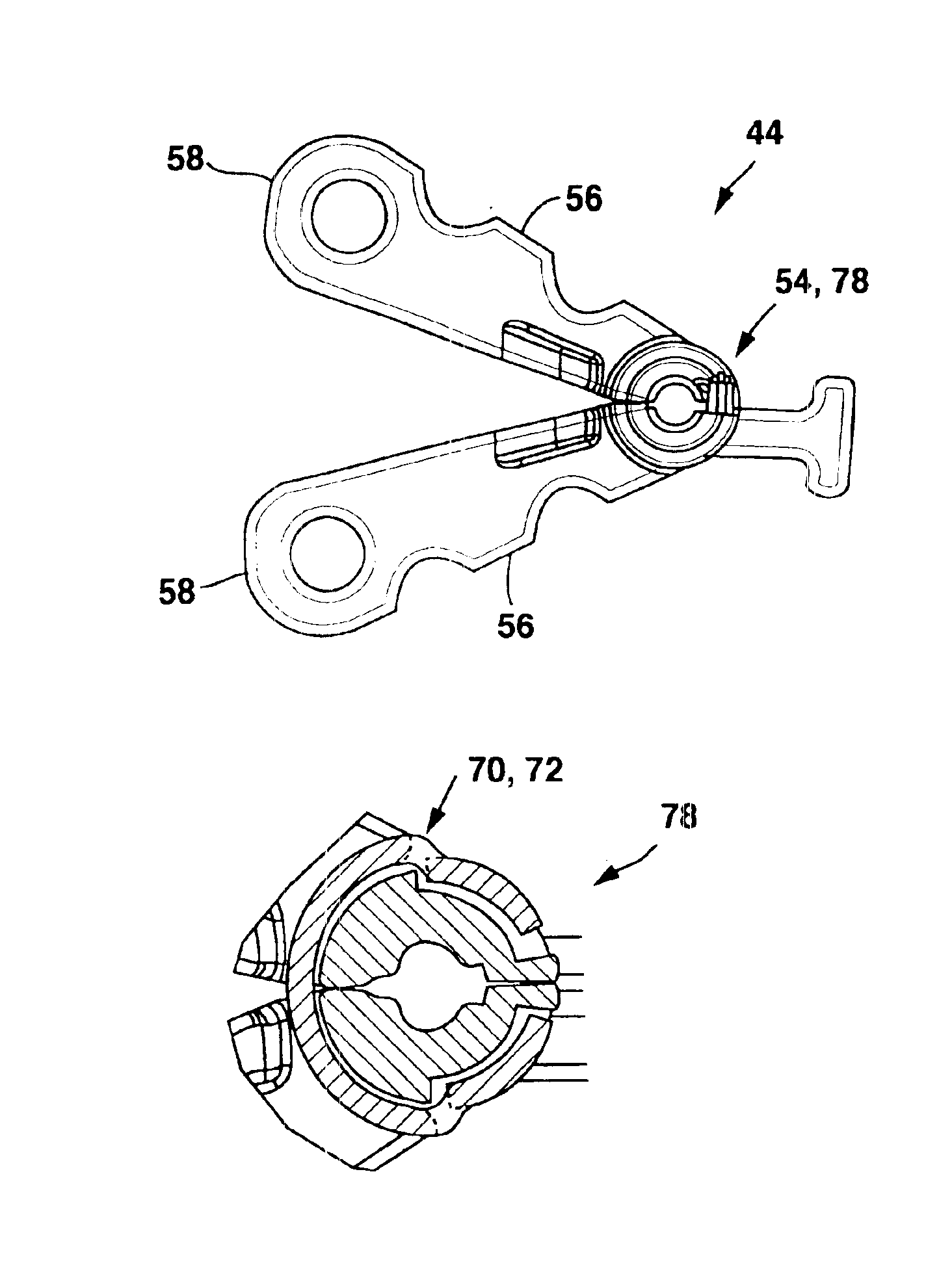 Implantable therapy delivery element adjustable anchor