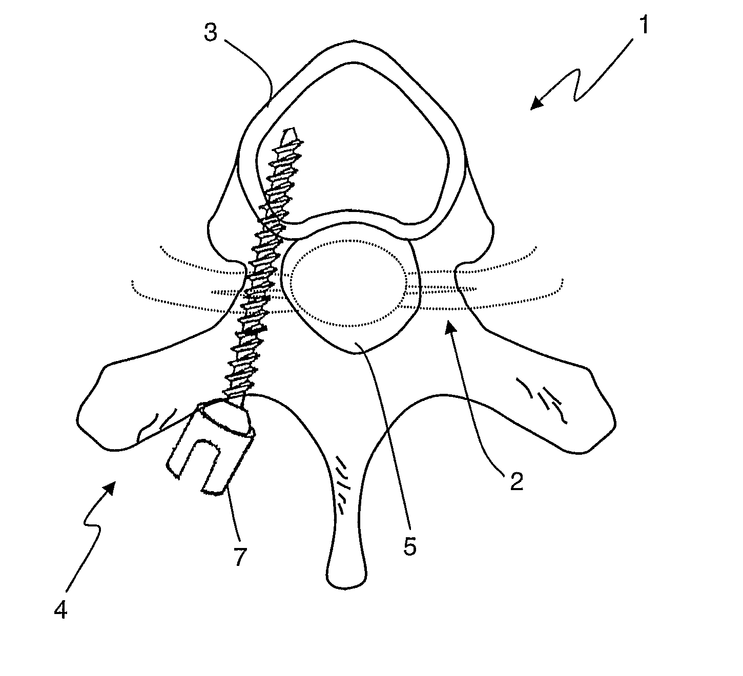 System and methods for performing pedicle integrity assessments of the thoracic spine