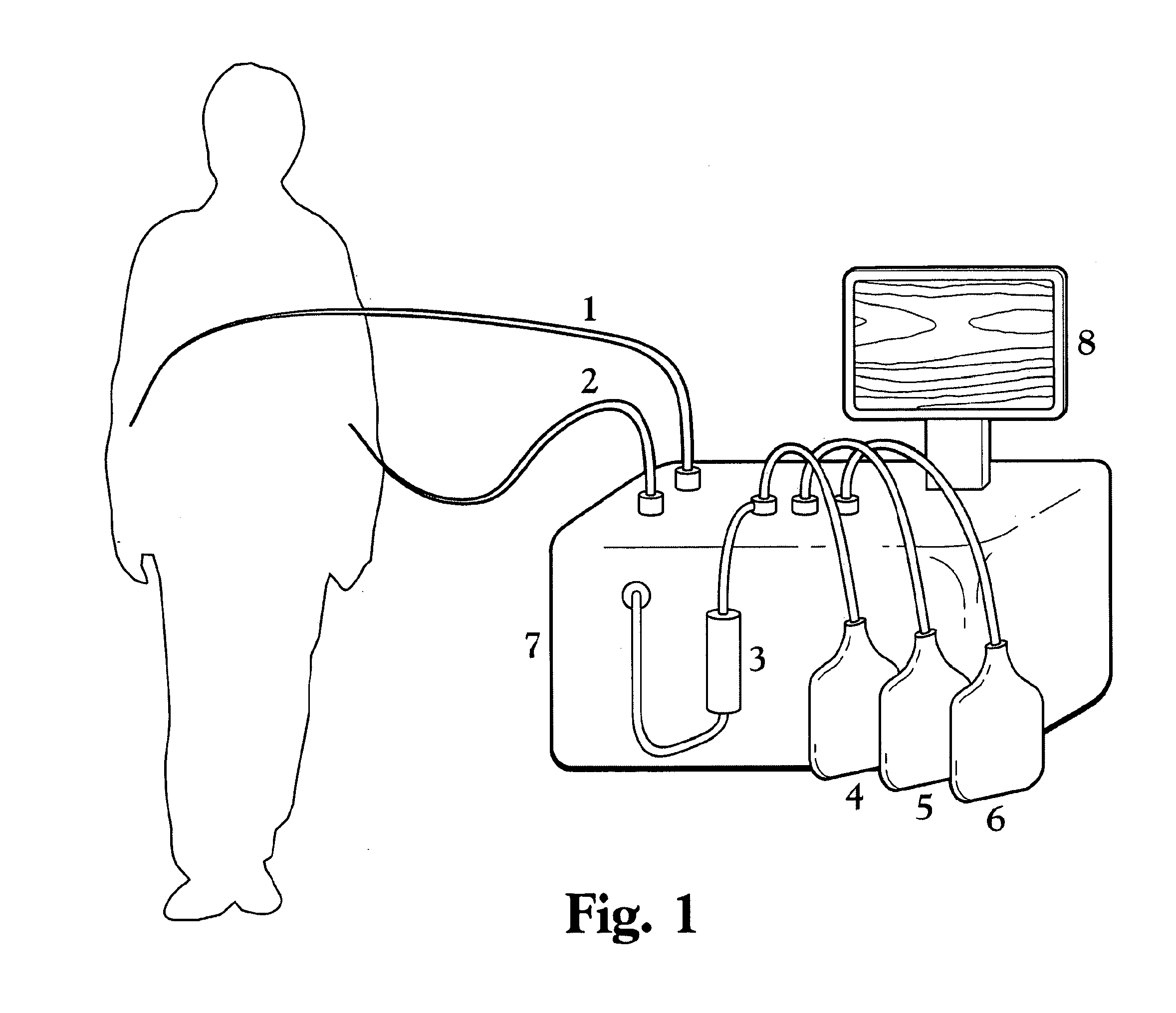 A Blood Purification Method and Apparatus for the Treatment of Malaria