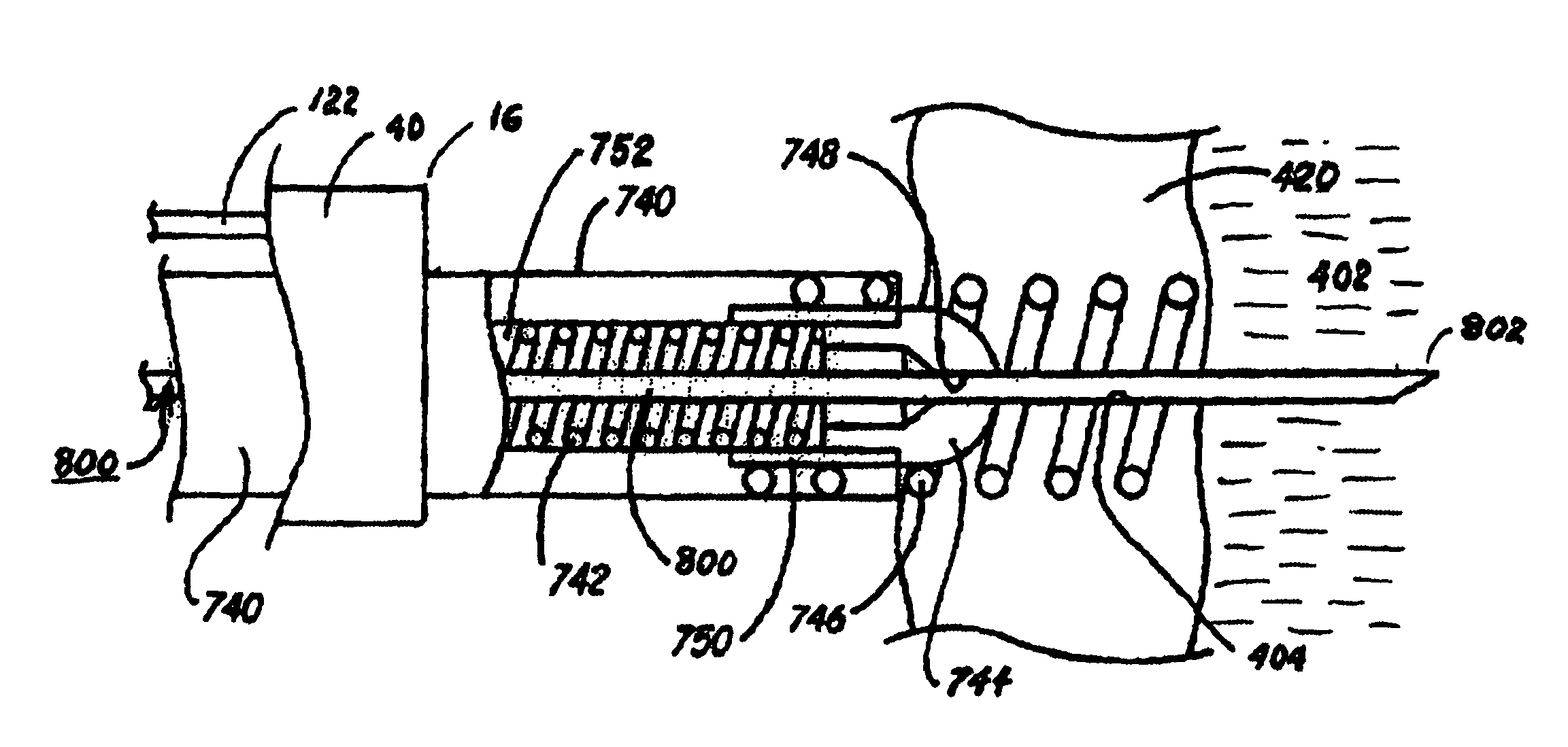 Methods and systems for accessing the pericardial space