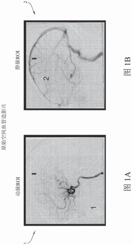 Spatiotemporal reconstruction of a moving vascular pulse wave from a plurality of lower dimensional angiographic projections