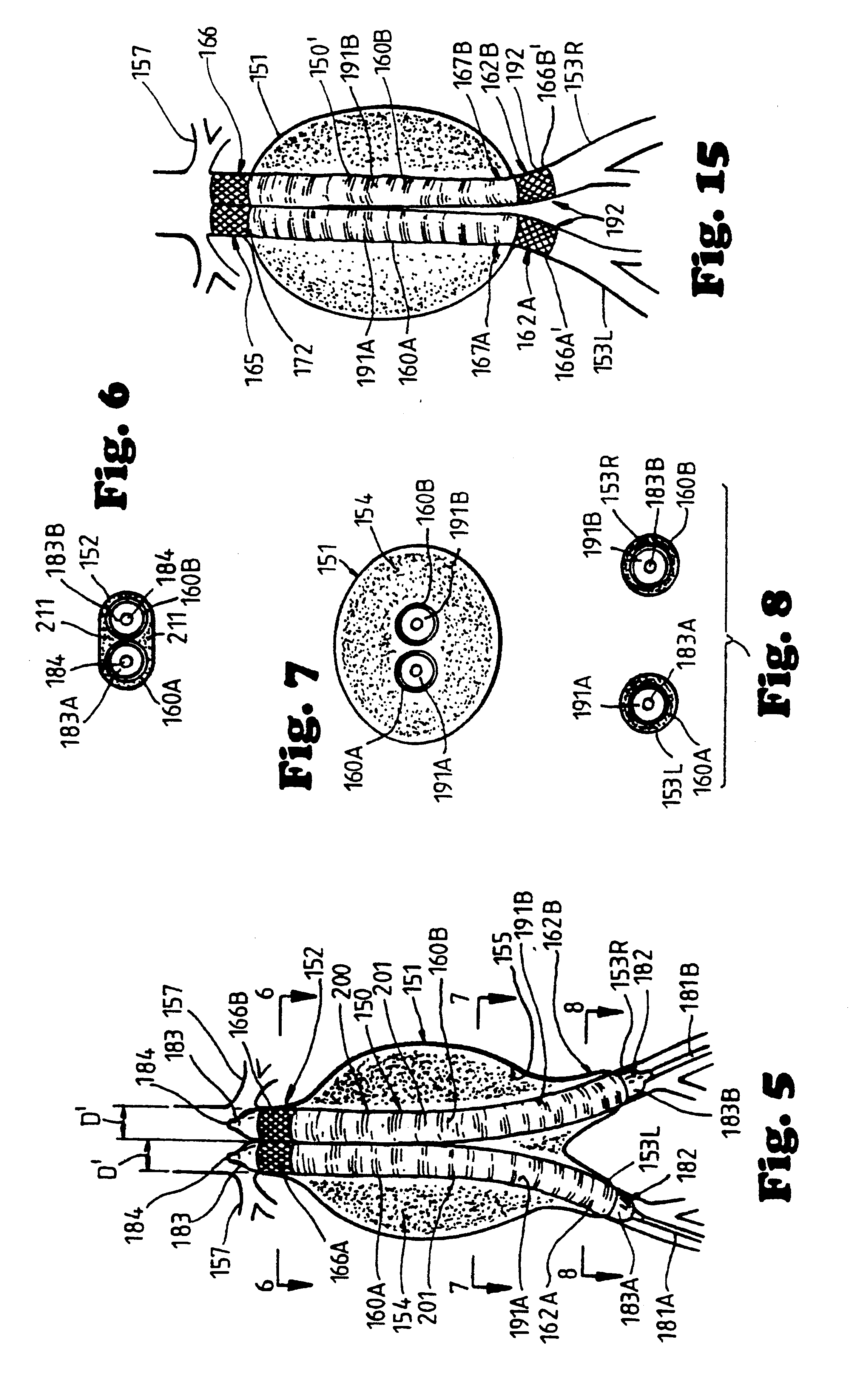 Method and apparatus for bilateral intra-aortic bypass