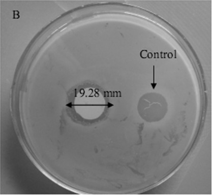 Edible fishskin collagen antibiosis membrane and preparing method thereof