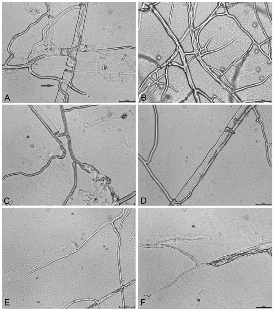 Trichoderma harzianum SQ-18 strain and application thereof to prevention and treatment of turfgrass diseases