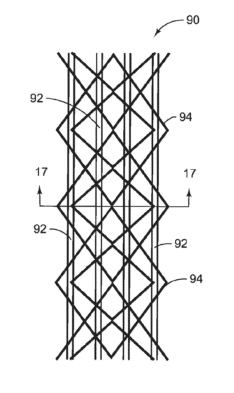 Plated tubular lattice structure