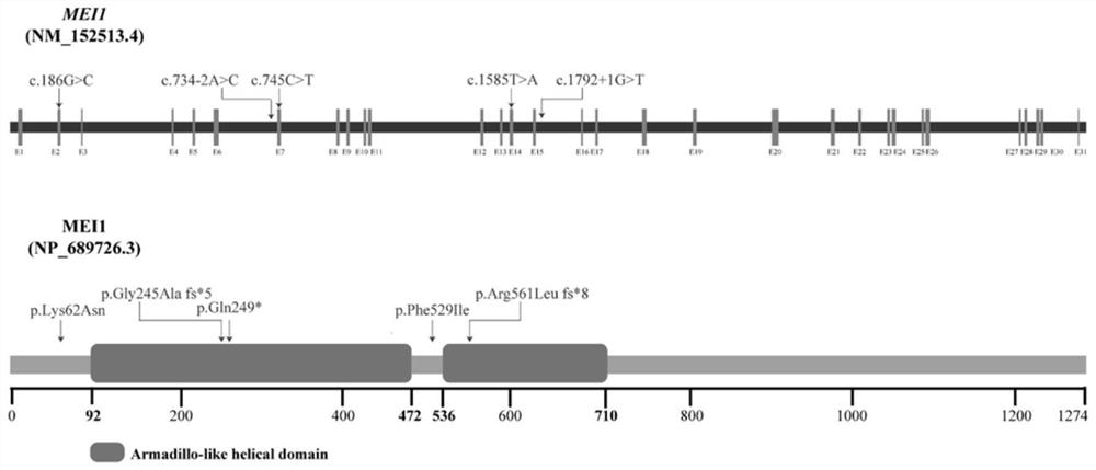 MEI1 gene for detecting female primary infertility and kit for detecting gene mutation