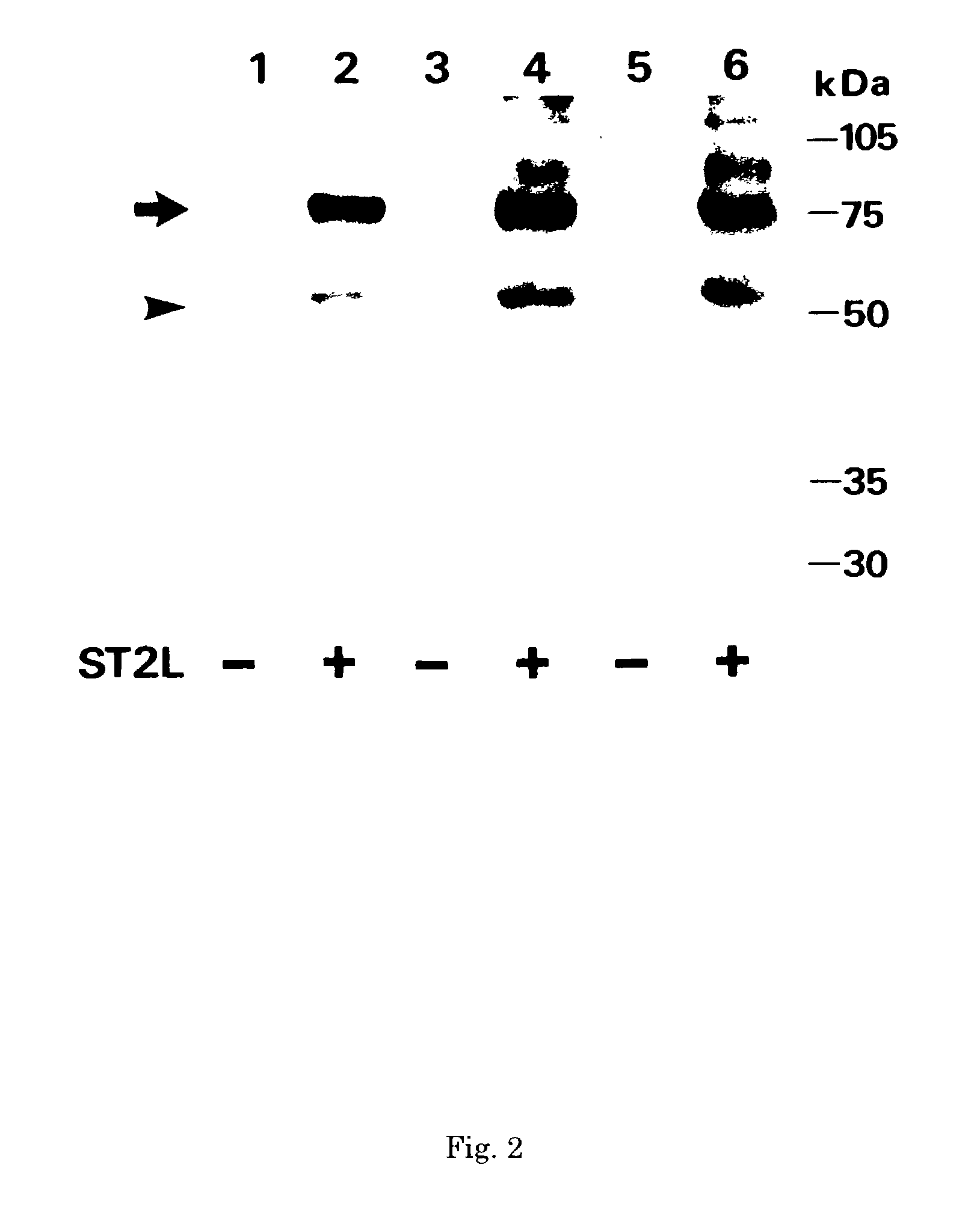 Monoclonal antibody and method and kit for immunoassay of soluble human ST2