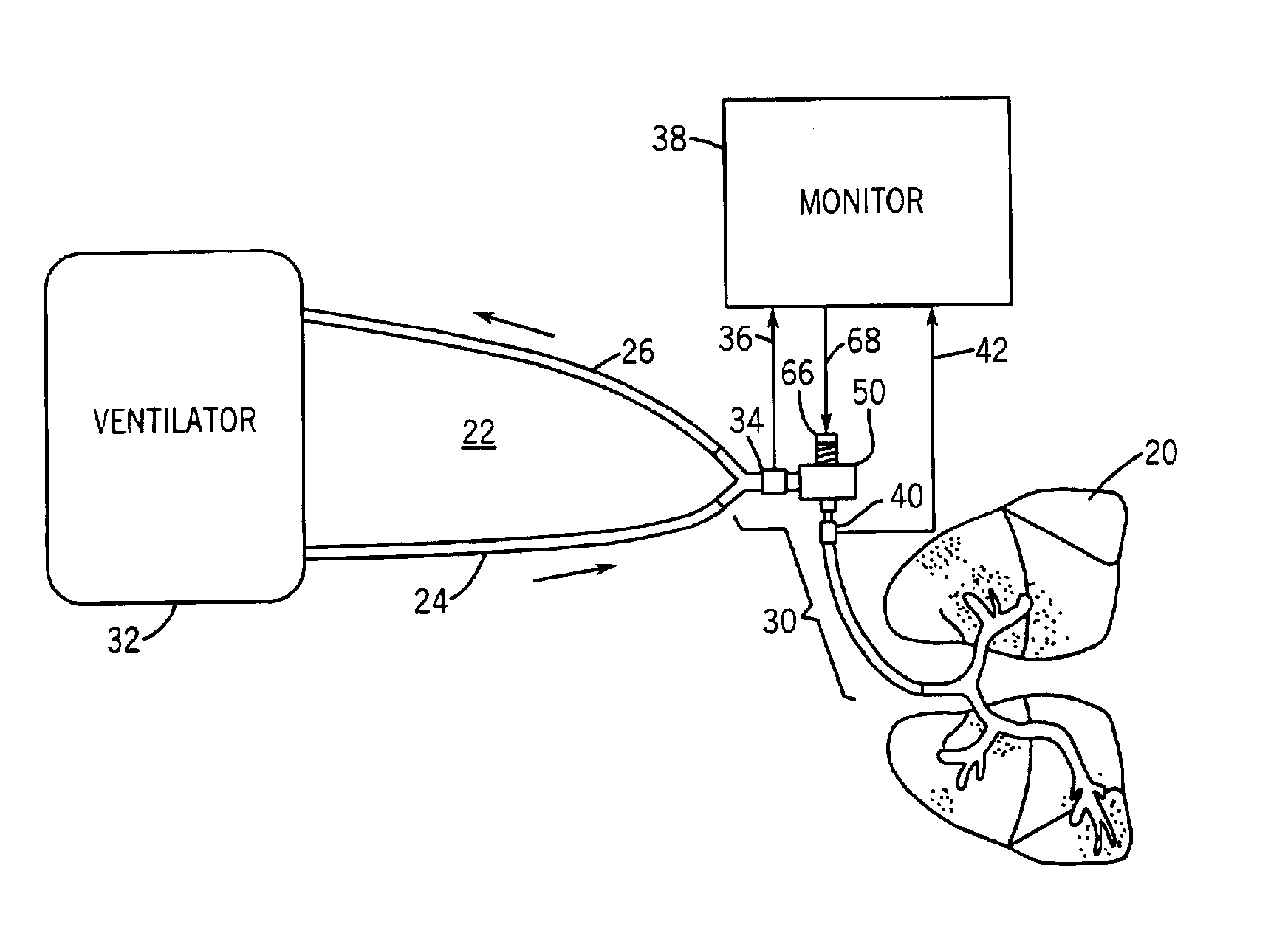 Apparatus and method for use in non-invasively determining conditions in the circulatory system of a subject