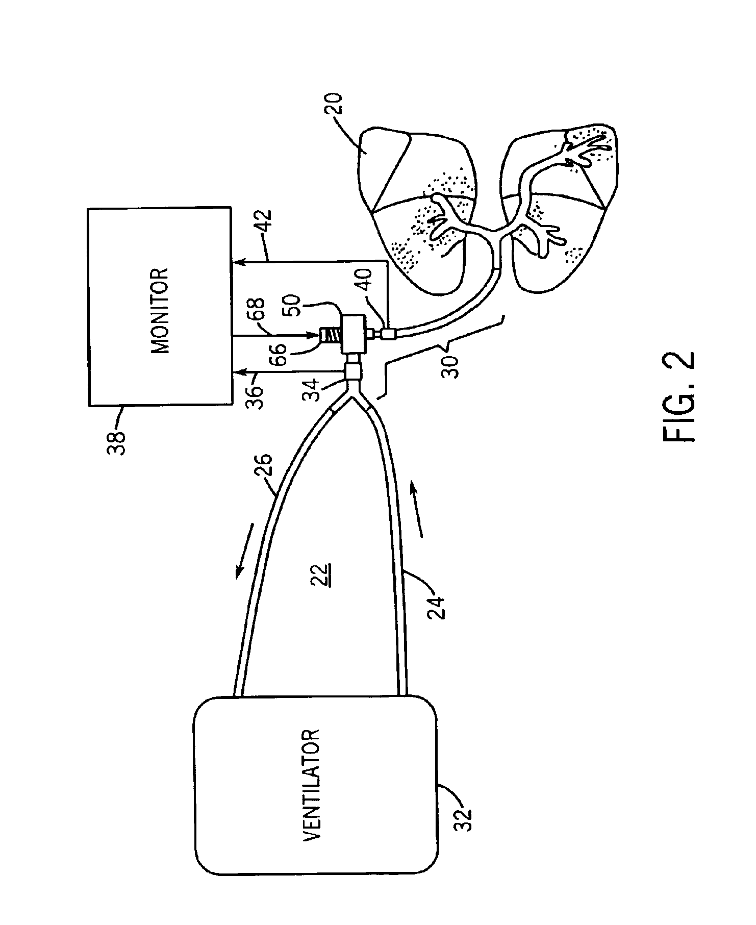 Apparatus and method for use in non-invasively determining conditions in the circulatory system of a subject