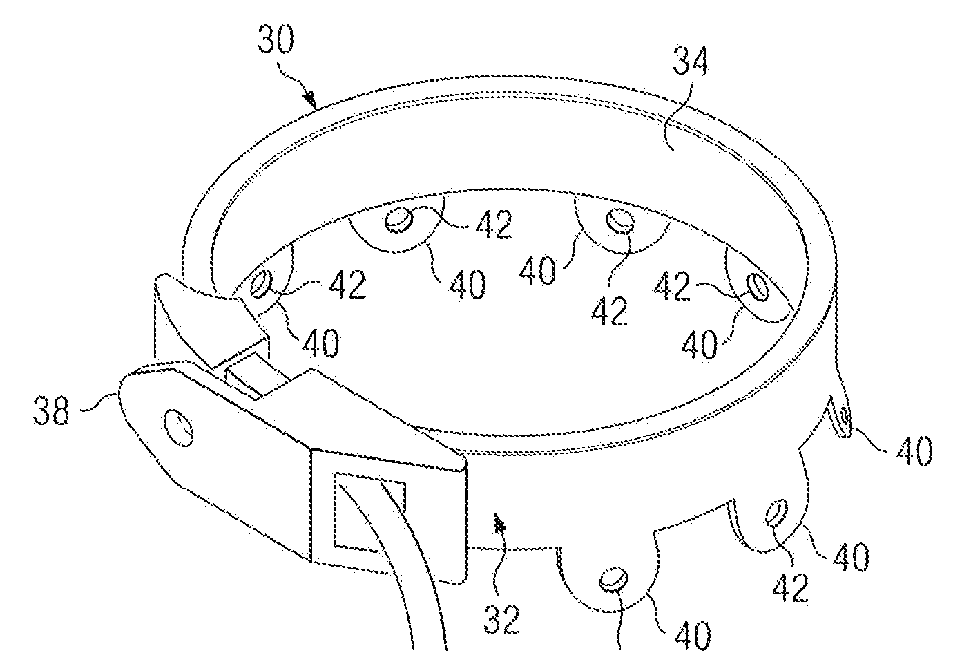 Method of and apparatus for prevention of adjustable gastric band slips