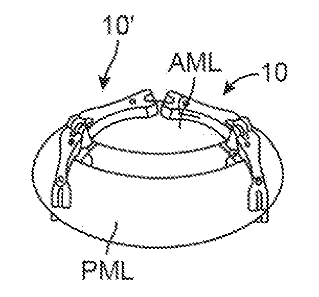 System for mitral valve repair and replacement