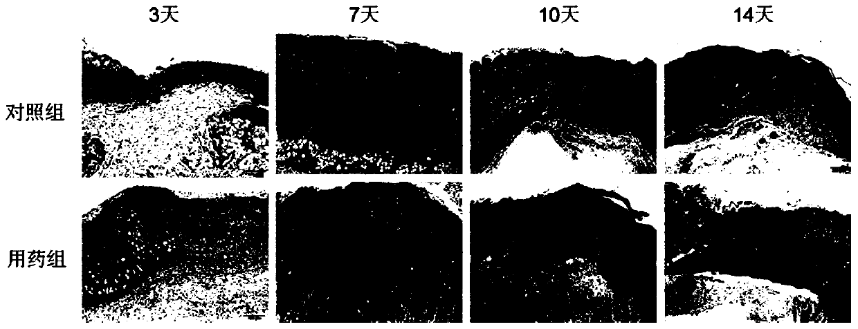 A kind of pharmaceutical composition and application thereof for promoting skin healing