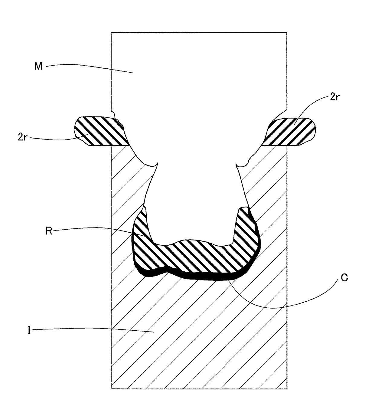 Method for producing temporary prosthesis