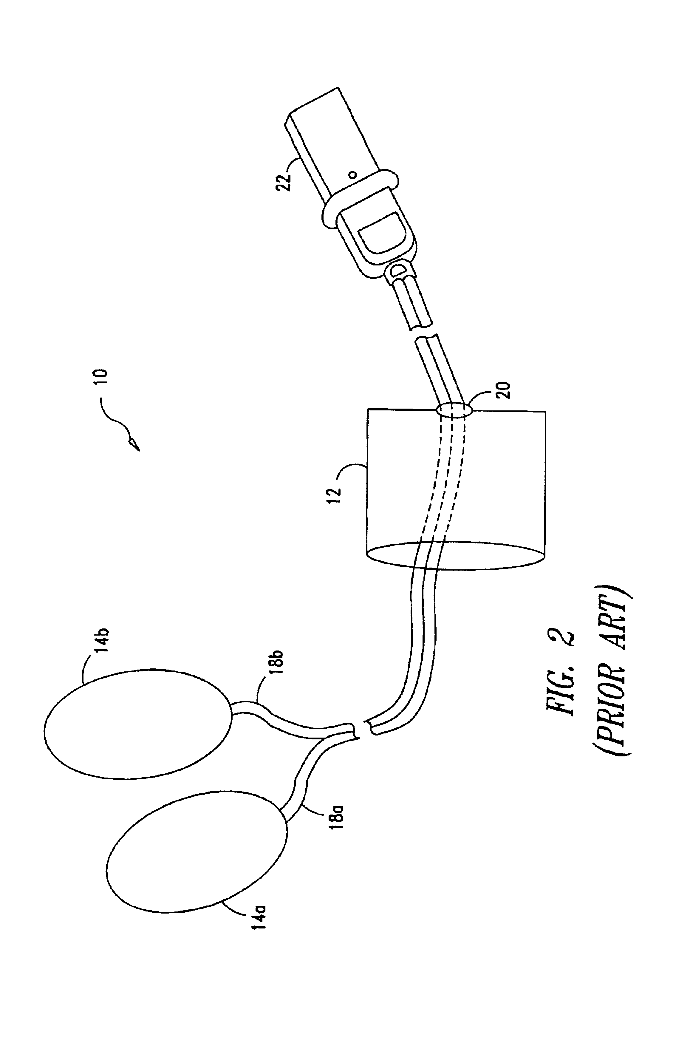 Electrode-pad package that is removable from an electrode-pad lead and method for opening the package