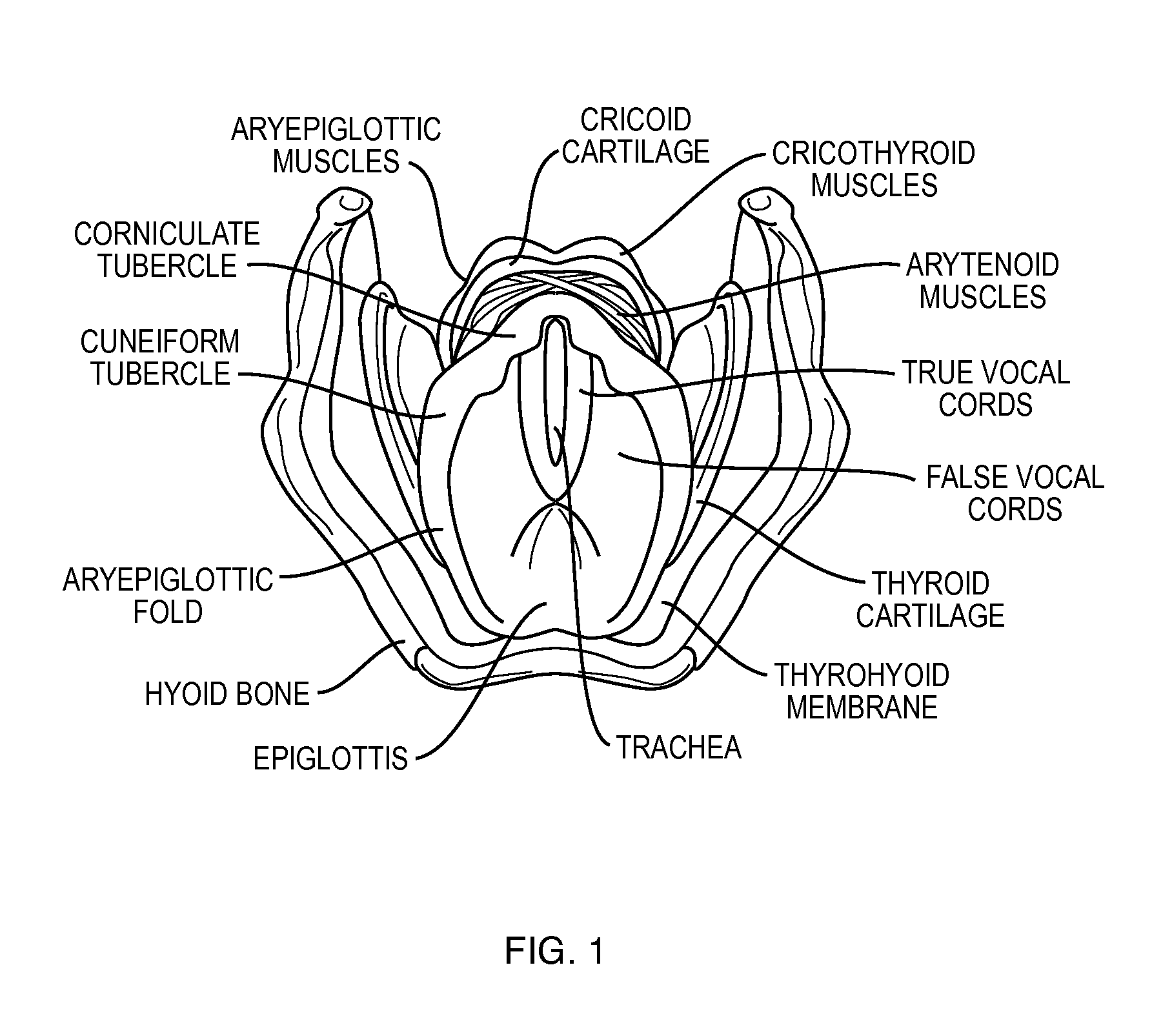 Stabilizing implant with expandable segments